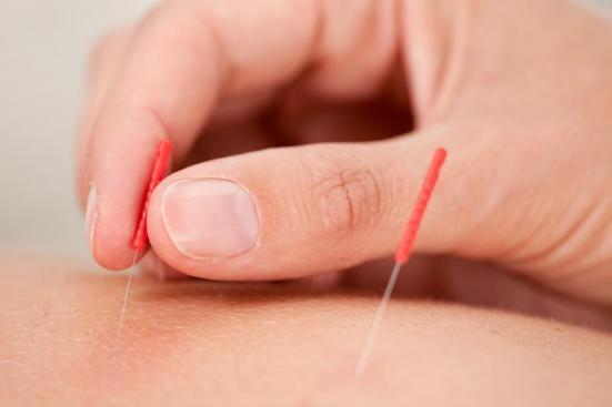 Acupunctura si slabitul