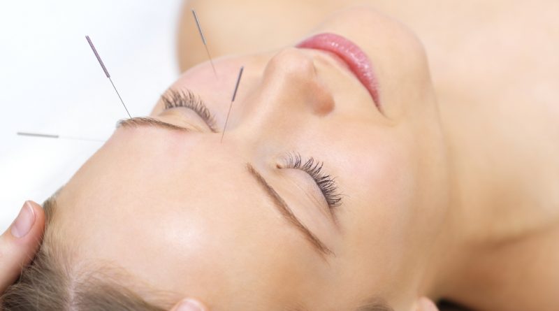 Acupunctura