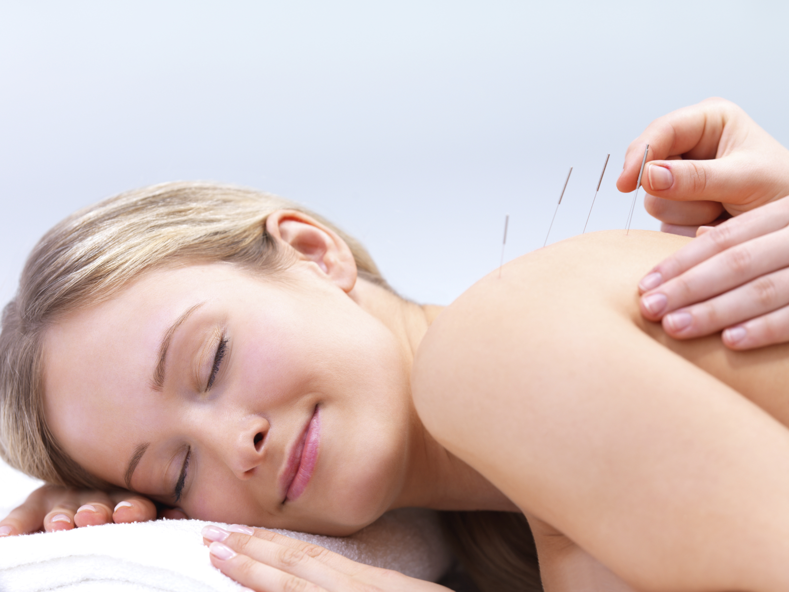 Acupunctura