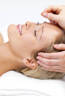 Acupunctura cosmetica