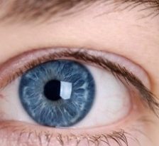 Intrebari si raspunsuri despre Keratoconus